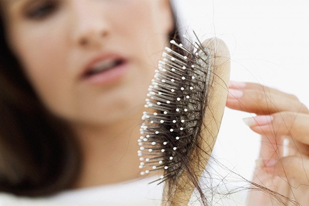 Hair Loss in Women Causes Treatment  Prevention